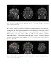 Galvos smegenų magnetinio rezonanso tomografijos tyrimas 8 puslapis