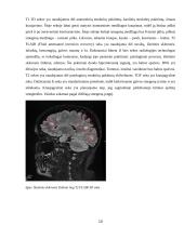 Galvos smegenų magnetinio rezonanso tomografijos tyrimas 9 puslapis