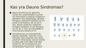 Dauno Sindromas (pristatymas) 2 puslapis