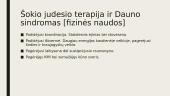 Dauno Sindromas (pristatymas) 6 puslapis