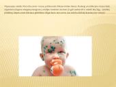 Skaidrės. Vėjaraupiai 3 puslapis