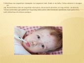 Skaidrės. Vėjaraupiai 4 puslapis