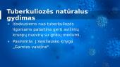 Tuberkuliozė. Pristatymas 12 puslapis