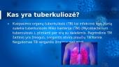 Tuberkuliozė. Pristatymas 2 puslapis