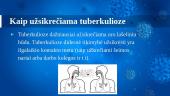 Tuberkuliozė. Pristatymas 5 puslapis