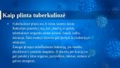Tuberkuliozė. Pristatymas 8 puslapis