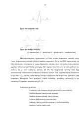 Ikistacionarinė pagalba ir slauga įtariant ūmų miokardo infarktą 14 puslapis