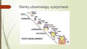 Dantų vystymasis 3 puslapis