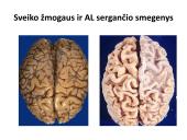 Integruota demencija sergančiųjų priežiūra 13 puslapis