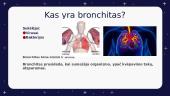Bronchitas. Skaidrės 2 puslapis