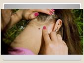 Erkės. Kaip apsisaugoti 16 puslapis