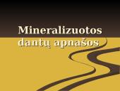 Mineralizuotos dantų apnašos