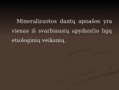 Mineralizuotos dantų apnašos 2 puslapis