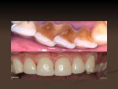 Mineralizuotos dantų apnašos 12 puslapis