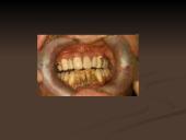 Mineralizuotos dantų apnašos 16 puslapis