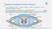 Nugaros smegenų dangalai ir ertmės 7 puslapis