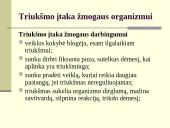 Klausa ir garsinė informacija (ergonomika) 13 puslapis
