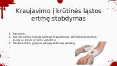 Kraujavimo stabdymas 13 puslapis