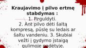 Kraujavimo stabdymas 14 puslapis