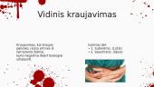 Kraujavimo stabdymas 9 puslapis