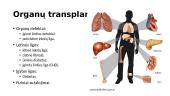 MHC ir transplantato atmetimas