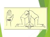 Pirmoji pagalba (skaidrės) 14 puslapis