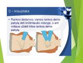 Pirmoji pagalba (skaidrės) 15 puslapis