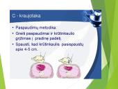 Pirmoji pagalba (skaidrės) 16 puslapis