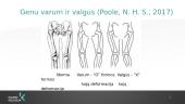 Genu varum valgus ir kineziterapija 2 puslapis