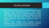 Rachitas, jo profilaktika, rachitu sergančių vaikų slaugos ypatumai 7 puslapis