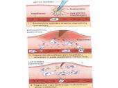 Infekcinės ligos ir imunitetas 11 puslapis