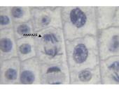 Ląstelių dalijimasis, gyvavimo ciklas 15 puslapis