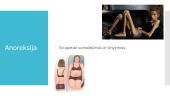 Badavimas, anoreksija ir nutukimas. Vainikinių širdies arterijų ligos 9 puslapis