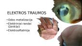 Elekros srovės poveikis žmogui 9 puslapis