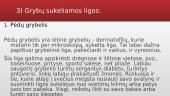 Mikroorganizmaai ir ligos 12 puslapis