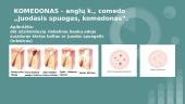 Komedogeninė oda 2 puslapis