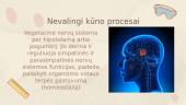 Skaidrės. Nervų sistema 9 puslapis