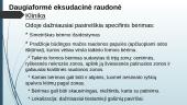 Daugiaformė eksudacinė raudonė 5 puslapis