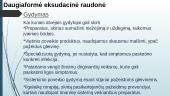 Daugiaformė eksudacinė raudonė 8 puslapis