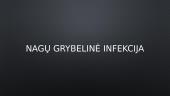 Nagų grybelinė infekcija