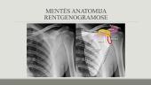 Viršutinių galūnių kaulų radiologinė ir topografinė anatomija 14 puslapis