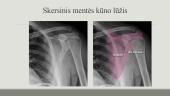 Viršutinių galūnių kaulų radiologinė ir topografinė anatomija 15 puslapis
