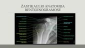 Viršutinių galūnių kaulų radiologinė ir topografinė anatomija 19 puslapis