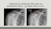 Viršutinių galūnių kaulų radiologinė ir topografinė anatomija 10 puslapis