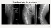 Rentgenologinis klubo sąnario ir šlaunikaulio tyrimas 6 puslapis