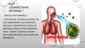 Oro lašelinės infekcijos. Difterija 6 puslapis