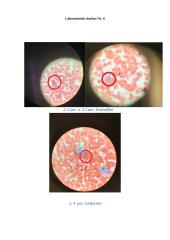 Kraujo sudėtis. Imuninių kraujo ląstelių stebėjimas 2 puslapis