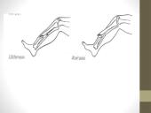 Pirmoji medicinos pagalba sumušimų, žaizdų ir kaulų lūžių atvejais 15 puslapis