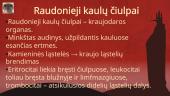 Kraujas (apytaka, krešėjimas, sutrikimai) 13 puslapis