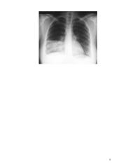 Kvėpavimo organų infekcinės ligos. Rūkymas 9 puslapis